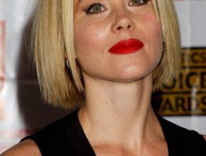 Christina Applegate plastic surgery 3