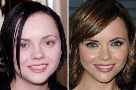 Christina Ricci before and after plastic surgery
