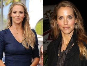 Elizabeth Berkley before and after plastic surgery