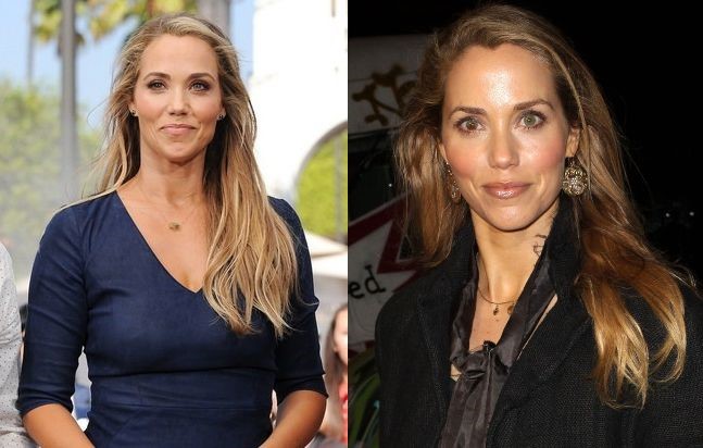 Elizabeth Berkley before and after plastic surgery