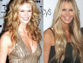Elle Macpherson before and after plastic surgery