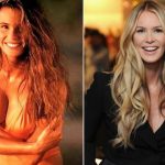 Elle Macpherson before and after plastic surgery 10