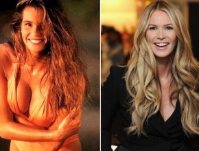 Elle Macpherson before and after plastic surgery 10