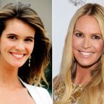 Elle Macpherson before and after plastic surgery 17