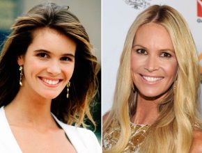 Elle Macpherson before and after plastic surgery 17
