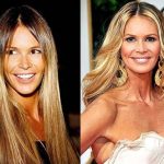 Elle Macpherson before and after plastic surgery 25