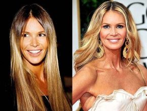 Elle Macpherson before and after plastic surgery 25