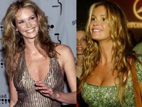 Elle Macpherson before and after plastic surgery 5
