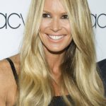 Elle Macpherson plastic surgery 16