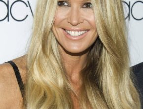 Elle Macpherson plastic surgery 16