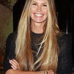 Elle Macpherson plastic surgery 20