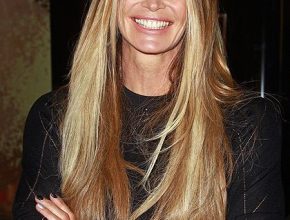 Elle Macpherson plastic surgery 20