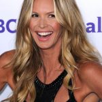 Elle Macpherson plastic surgery 23