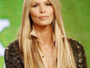 Elle Macpherson plastic surgery 34