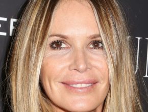 Elle Macpherson plastic surgery