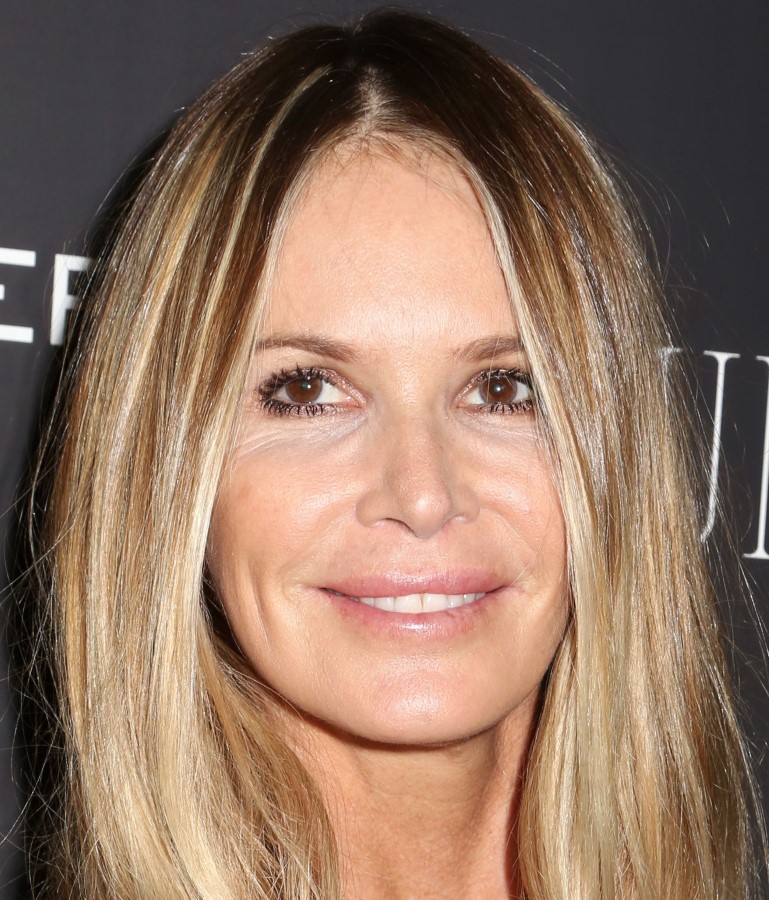 Elle Macpherson plastic surgery