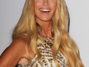 Elle Macpherson plastic surgery 6