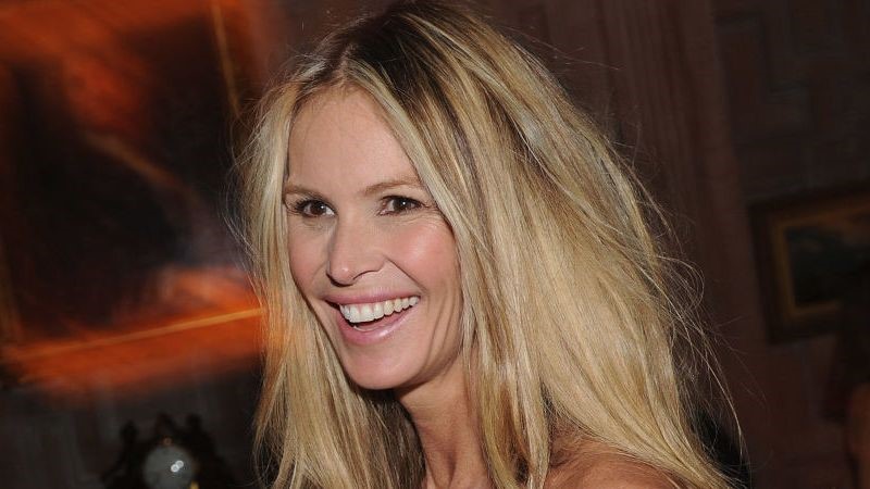 Elle Macpherson plastic surgery