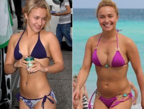 Hayden Panettiere before and after plastic surgery