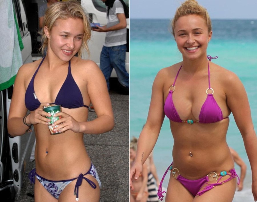 Hayden Panettiere before and after plastic surgery