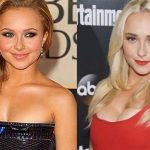 Hayden Panettiere before and after plastic surgery 10