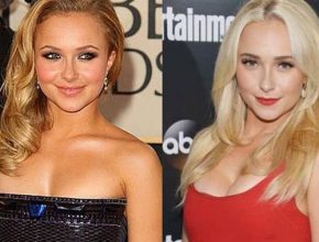 Hayden Panettiere before and after plastic surgery 10