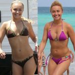 Hayden Panettiere before and after plastic surgery 24