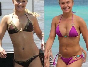 Hayden Panettiere before and after plastic surgery 24