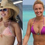 Hayden Panettiere before and after plastic surgery 5