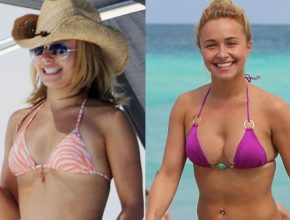 Hayden Panettiere before and after plastic surgery 5