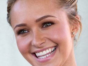 Hayden Panettiere plastic surgery 6