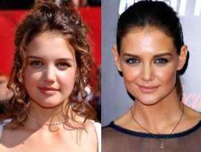 Katie Holmes before plastic surgery 5