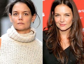 Katie Holmes before plastic surgery 8