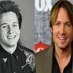 Keith Urban before and after plastic surgery 1