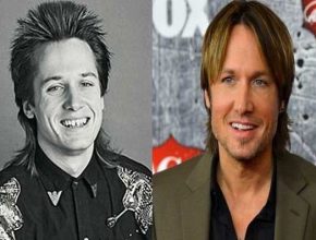 Keith Urban before and after plastic surgery 1