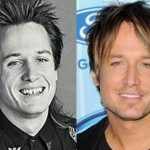 Keith Urban before and after plastic surgery 2