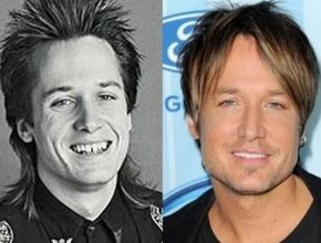 Keith Urban before and after plastic surgery 2