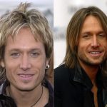Keith Urban before and after plastic surgery 22