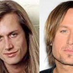 Keith Urban before and after plastic surgery 7