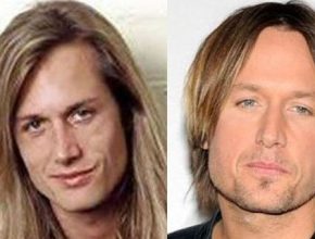 Keith Urban before and after plastic surgery 7