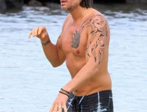 Keith Urban plastic surgery 24