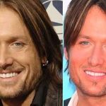 Keith Urban plastic surgery 3