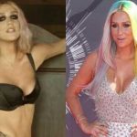 Kesha before and after plastic surgery 31