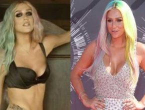 Kesha before and after plastic surgery 31