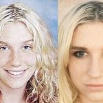 Kesha before and after plastic surgery 38