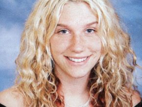 Kesha plastic surgery 1