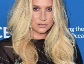 Kesha plastic surgery 14