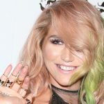 Kesha plastic surgery 16