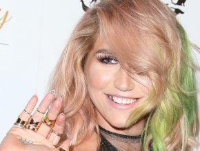 Kesha plastic surgery 16