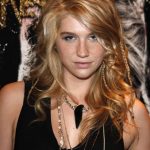 Kesha plastic surgery 20